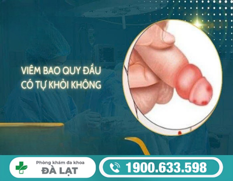 Hình ảnh minh họa